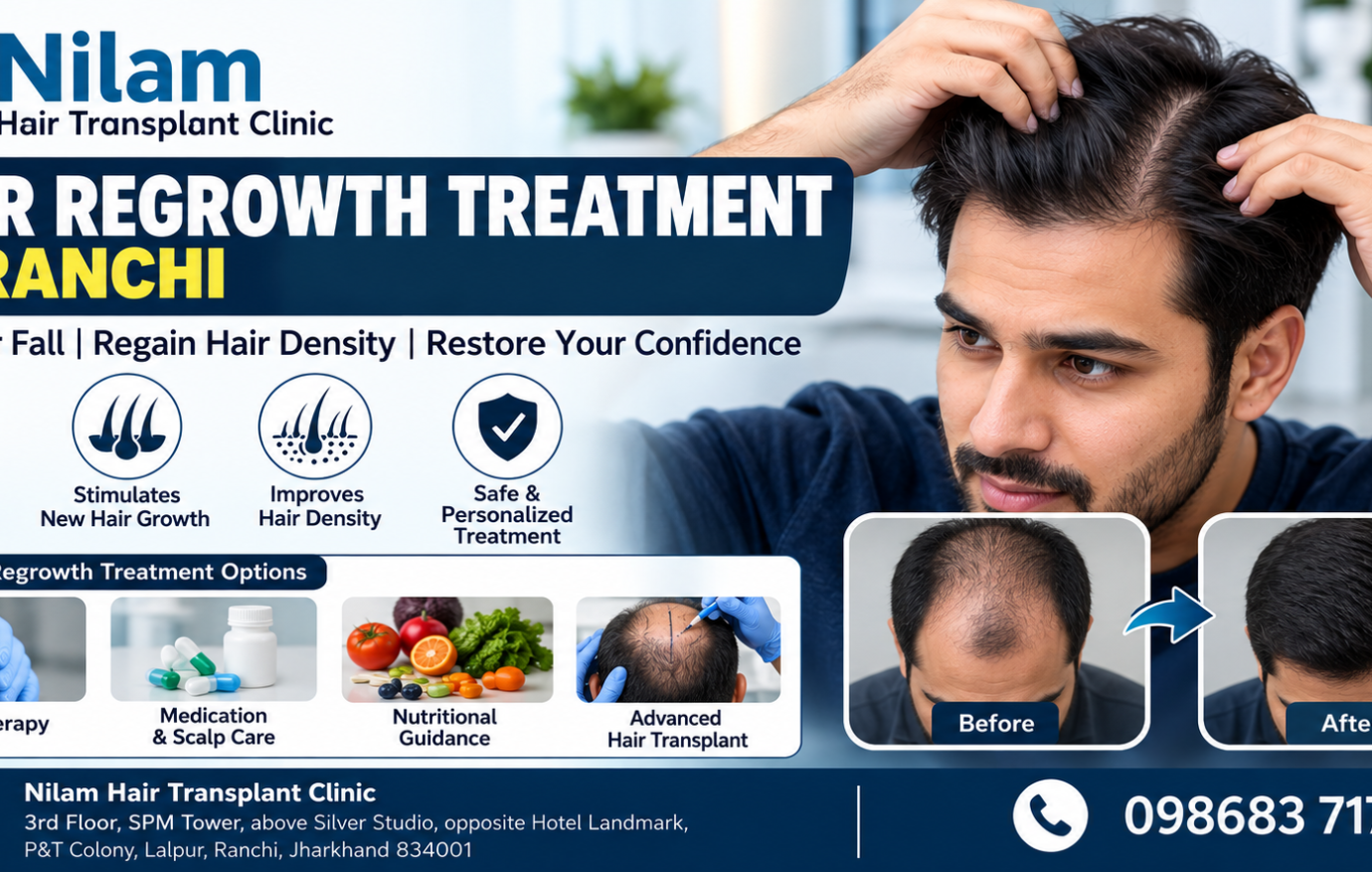 Hair Regrowth Treatment in Ranchi
