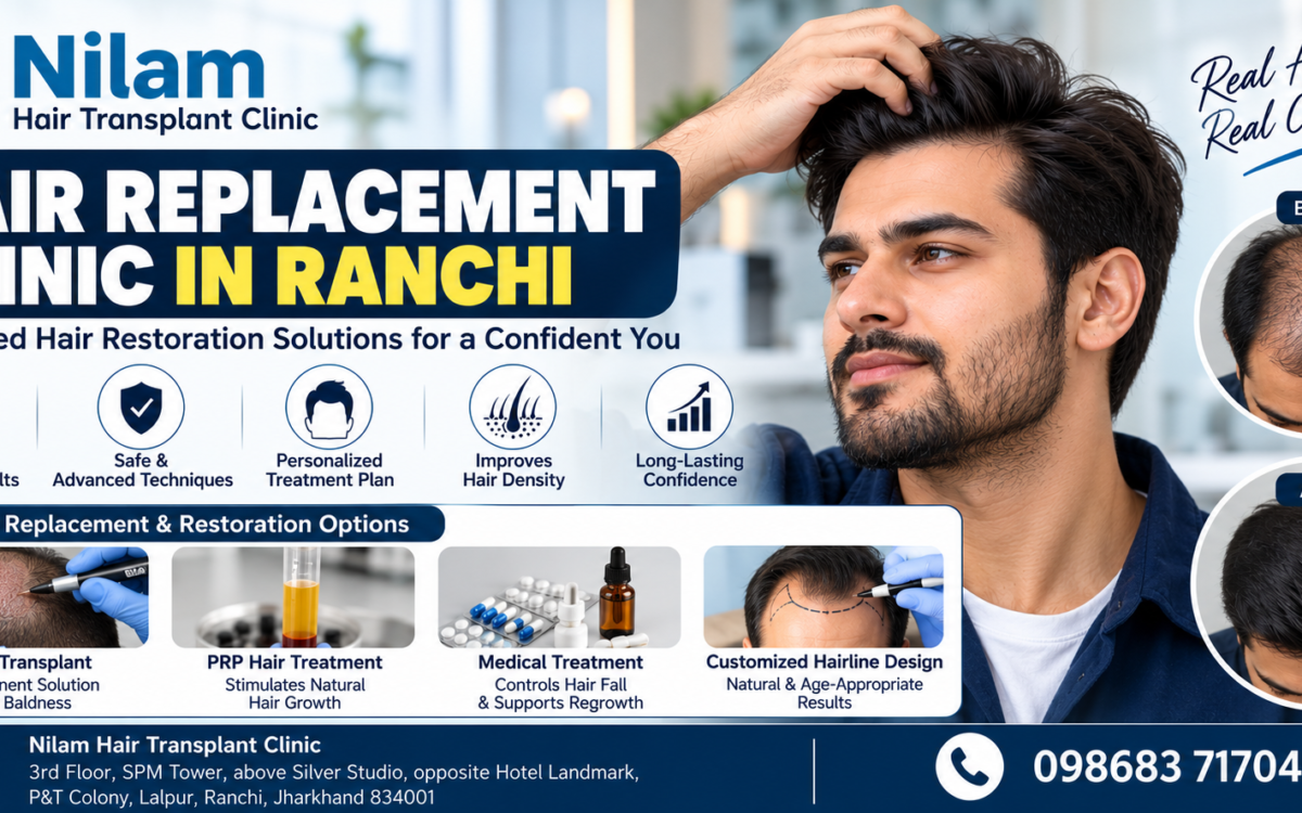 Hair Replacement Clinic in Ranch