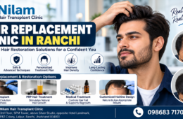 Hair Replacement Clinic in Ranchi – Advanced Hair Restoration Solutions at Nilam Hair Transplant Clinic