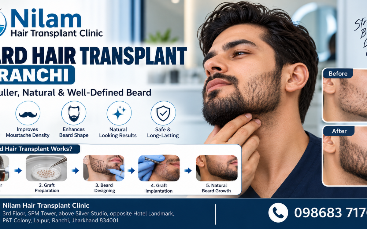 Beard Hair Transplant in Ranchi
