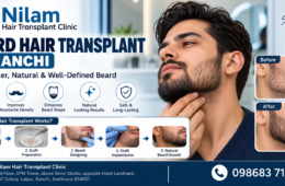 Beard Hair Transplant in Ranchi – Natural Beard Restoration at Nilam Hair Transplant Clinic
